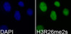 Immunofluorescence analysis of 293T cells using Symmetric DiMethyl-Histone H3-R26 Polyclonal Antibody