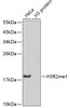 Western blot analysis of extracts of various cell lines using MonoMethyl-Histone H3-R2 Polyclonal Antibody.