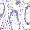 Immunohistochemistry of paraffin-embedded Human colon using Asymmetric DiMethyl-Histone H3-R2 Polyclonal Antibody at dilution of  1:100 (40x lens).