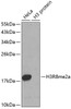 Western blot analysis of extracts of various cell lines using Asymmetric DiMethyl-Histone H3-R8 Polyclonal Antibody.