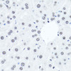 Immunohistochemistry of paraffin-embedded Mouse liver using Symmetric DiMethyl-Histone H4-R3 Polyclonal Antibody at dilution of  1:100 (40x lens).