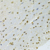 Immunohistochemistry of paraffin-embedded Rat brain using NLK Polyclonal Antibody at dilution of  1:100 (40x lens).