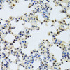 Immunohistochemistry of paraffin-embedded Mouse lung using NLK Polyclonal Antibody at dilution of  1:100 (40x lens).