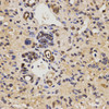 Immunohistochemistry of paraffin-embedded Mouse liver fibrosis using FAM160B2 Polyclonal Antibody at dilution of  1:200 (40x lens).