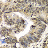 Immunohistochemistry of paraffin-embedded Human colon using UFD1L Polyclonal Antibody at dilution of  1:100 (40x lens).