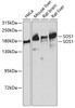 Western blot analysis of extracts of various cell lines using SOS1 Polyclonal Antibody at dilution of 1:1000.