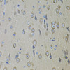 Immunohistochemistry of paraffin-embedded Rat brain using SMO Polyclonal Antibody