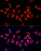 Immunofluorescence analysis of HeLa cells using SMO Polyclonal Antibody at dilution of  1:100 (40x lens). Blue: DAPI for nuclear staining.