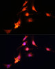 Immunofluorescence analysis of C6 cells using SUV39H1 Polyclonal Antibody at dilution of  1:100 (40x lens). Blue: DAPI for nuclear staining.