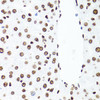 Immunohistochemistry of paraffin-embedded Rat liver using Histone H1.0 Polyclonal Antibody at dilution of  1:100 (40x lens).