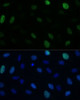 Immunofluorescence analysis of U-2 OS cells using KIFC1 Polyclonal Antibody at dilution of  1:100 (40x lens). Blue: DAPI for nuclear staining.