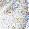 Immunohistochemistry of paraffin-embedded Human esophagus using LRPPRC Polyclonal Antibody at dilution of  1:100 (40x lens).