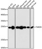 Western blot analysis of extracts of various cell lines using TMED9 Polyclonal Antibody at dilution of 1:3000.