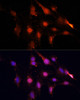 Immunofluorescence analysis of C6 cells using NSUN2 Polyclonal Antibody at dilution of  1:100. Blue: DAPI for nuclear staining.