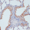 Immunohistochemistry of paraffin-embedded Mouse lung using SLC39A4 Polyclonal Antibody at dilution of  1:100 (40x lens).