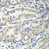 Immunohistochemistry of paraffin-embedded Human stomach using CCT6A Polyclonal Antibody at dilution of  1:100 (40x lens).