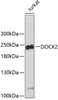 Western blot analysis of extracts of Jurkat cells using DOCK2 Polyclonal Antibody.