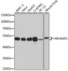 Western blot analysis of extracts of various cell lines using ARHGAP1 Polyclonal Antibody at dilution of 1:1000.