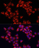 Immunofluorescence analysis of HeLa cells using ARHGAP1 Polyclonal Antibody at dilution of  1:100. Blue: DAPI for nuclear staining.
