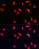 Immunofluorescence analysis of HeLa cells using ATP6V1B2 Polyclonal Antibody at dilution of  1:100. Blue: DAPI for nuclear staining.