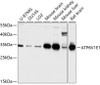 Western blot analysis of extracts of various cell lines using ATP6V1E1 Polyclonal Antibody at dilution of 1:1000.
