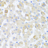 Immunohistochemistry of paraffin-embedded Human liver damage using CETN1 Polyclonal Antibody at dilution of  1:100 (40x lens).
