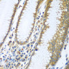 Immunohistochemistry of paraffin-embedded Human stomach using FUT6 Polyclonal Antibody at dilution of  1:100 (40x lens).