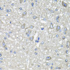 Immunohistochemistry of paraffin-embedded Rat brain using GFPT1 Polyclonal Antibody at dilution of  1:100 (40x lens).