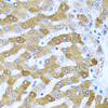 Immunohistochemistry of paraffin-embedded Human liver using IFIT3 Polyclonal Antibody at dilution of  1:100 (40x lens).