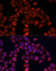 Immunofluorescence analysis of HeLa cells using MOV10 Polyclonal Antibody at dilution of  1:100. Blue: DAPI for nuclear staining.