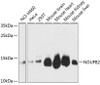 Western blot analysis of extracts of various cell lines using NDUFB2 Polyclonal Antibody at dilution of 1:3000.