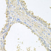Immunohistochemistry of paraffin-embedded Human prostate using PMM2 Polyclonal Antibody at dilution of  1:100 (40x lens).