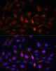 Immunofluorescence analysis of U-2 OS cells using PSMA7 Polyclonal Antibody at dilution of  1:100. Blue: DAPI for nuclear staining.