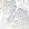 Immunohistochemistry of paraffin-embedded Human esophagus using STAU1 Polyclonal Antibody at dilution of  1:100 (40x lens).