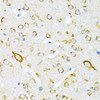 Immunohistochemistry of paraffin-embedded Mouse brain using VARS Polyclonal Antibody at dilution of  1:100 (40x lens).