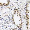Immunohistochemistry of paraffin-embedded Human prostate using SAFB2 Polyclonal Antibody at dilution of  1:100 (40x lens).