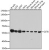 Western blot analysis of extracts of various cell lines using CCT8 Polyclonal Antibody at dilution of 1:7000.