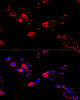 Immunofluorescence analysis of HeLa cells using CCT8 Polyclonal Antibody at dilution of  1:100 (40x lens). Blue: DAPI for nuclear staining.