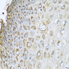 Immunohistochemistry of paraffin-embedded Human esophagus using PHB2 Polyclonal Antibody at dilution of  1:100 (40x lens).