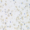 Immunohistochemistry of paraffin-embedded Mouse brain using COTL1 Polyclonal Antibody at dilution of  1:100 (40x lens).
