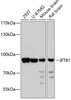 Western blot analysis of extracts of various cell lines using IFT81 Polyclonal Antibody at dilution of 1:3000.