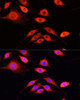 Immunofluorescence analysis of PC-12 cells using SERPINA10 Polyclonal Antibody at dilution of  1:100 (40x lens). Blue: DAPI for nuclear staining.