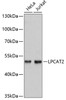 Western blot analysis of extracts of various cell lines using LPCAT2 Polyclonal Antibody at dilution of 1:3000.