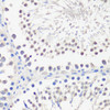 Immunohistochemistry of paraffin-embedded Rat testis using SPK Polyclonal Antibody at dilution of  1:100 (40x lens).