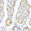 Immunohistochemistry of paraffin-embedded Human stomach using MRPL11 Polyclonal Antibody at dilution of  1:100 (40x lens).