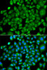 Immunofluorescence analysis of A549 cells using NAA50 Polyclonal Antibody