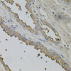 Immunohistochemistry of paraffin-embedded Human prostate using FMR1NB Polyclonal Antibody at dilution of  1:100 (40x lens).