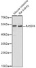 Western blot analysis of extracts of various cell lines using RASSF6 Polyclonal Antibody at dilution of 1:1000.