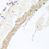 Immunohistochemistry of paraffin-embedded Mouse lung using CD81 Polyclonal Antibody at dilution of  1:100 (40x lens).