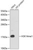 Western blot analysis of extracts of various cell lines using MonoMethyl-Histone H3-K14 Polyclonal Antibody.